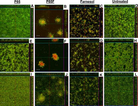 Morphology Of S Mutans Biofilms Grown With Pluronics Formulated