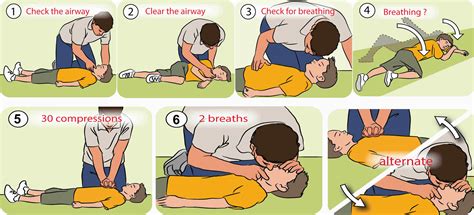 Cardiopulmonary Resuscitation Steps And Technique