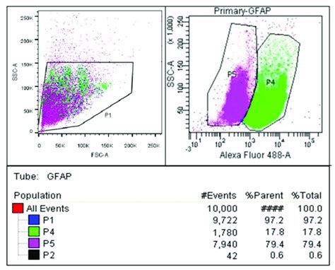 Glial Fibrillary Acidic Protein Gfap Immunophenotyping To Determine