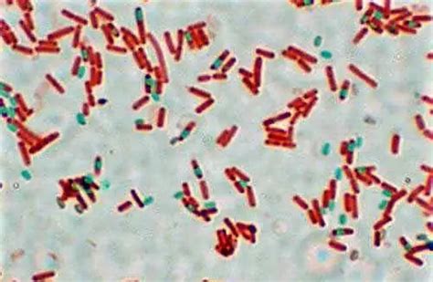 How To Identify Bacteria Microscope Clarity