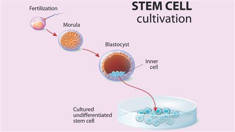 5 Stem Cell Therapy Benefits for Heart Disease, Joint Pain, & More ...