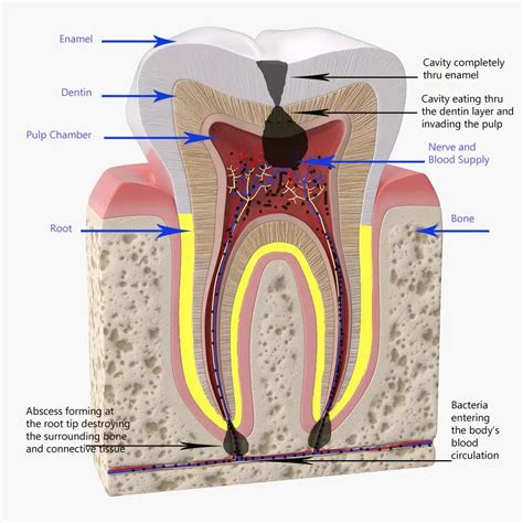 Most Common Teeth Diseases Platinum Dental Inc