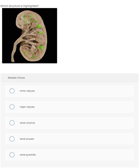 Solved Which structure is highlighted? Multiple Choice minor | Chegg.com