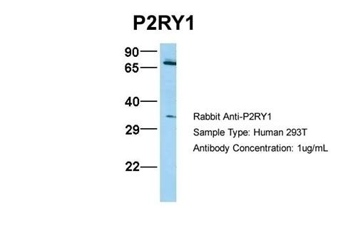P2RY12 Antibody - Cat. No. 26-598 | ProSci