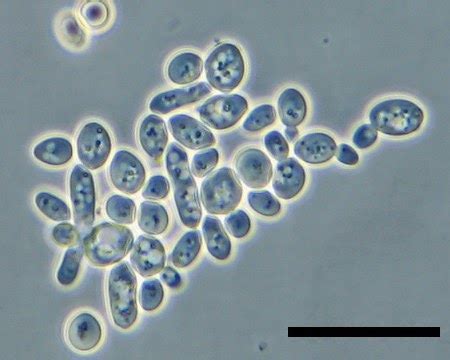 Yeast Cells Under Light Microscope