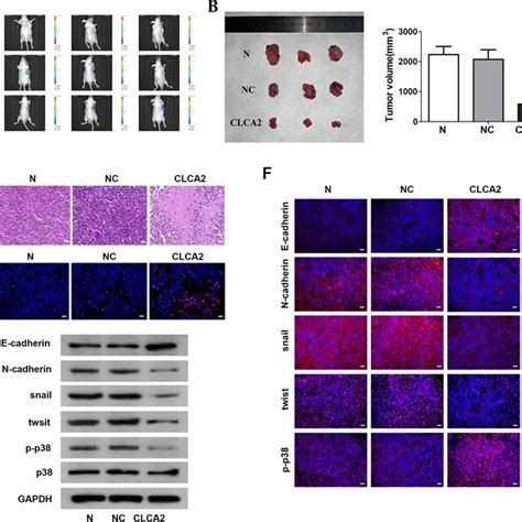 Clca Inhibits Emt And P Jnk Erk Pathway In Cervical Cancer