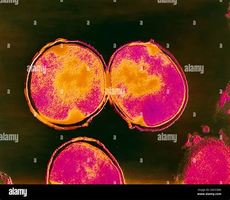 False Colour Transmission Electron Micrograph Tem Of The Gram