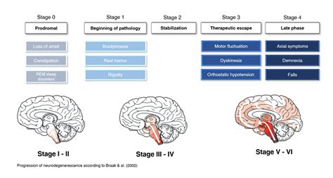 Parkinsons Disease Progression Stages Erofound