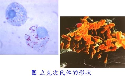 科学网—环境微生物之三体支原体、立克次氏体、衣原体 王从彦的博文