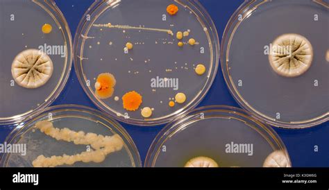 A Petri Dish With Growing Cultures Of Microorganisms Fungi And