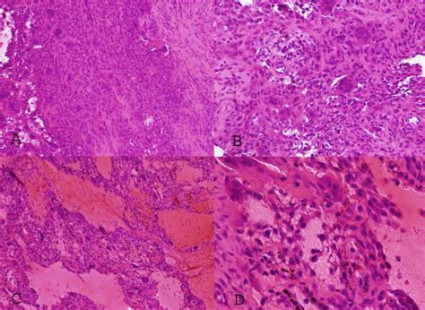 Photomicrographs A And B Illustrate The Proliferating