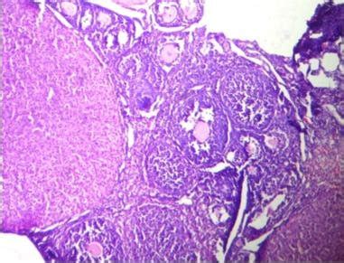 Ovary Of Control Mice Shows Normal Corpus Luteum Mature Graafian