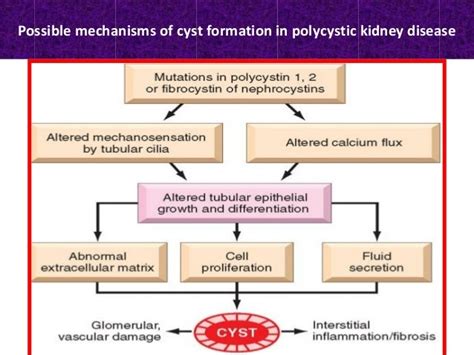 Polycystic kidney disease for students