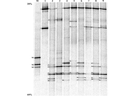 Polymerase Chain Reaction Denaturing Gradient Gel Electrophoresis Download Scientific Diagram