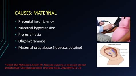 Meconium Stained Amniotic Fluid