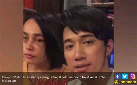 Soal Kasus Pengeroyokan Dicky Smash Balik Dilaporkan Ke Polisi