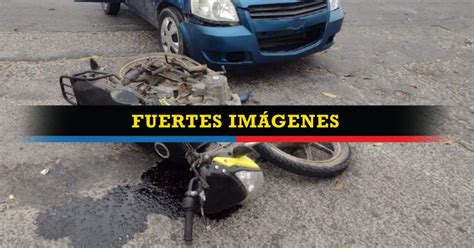 Choque Entre Una Moto Y Un Auto Deja Dos Personas Lesionadas