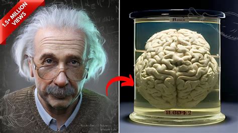 How Albert Einstein S Brain Was Different From Other Human Beings Youtube