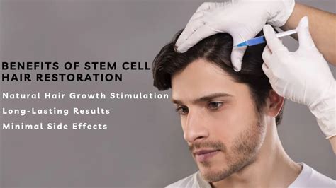 Stem Cell Hair Treatment A Promising Solution For Hair Loss