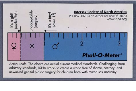 Intersex Genitalia Illustrated And Explained