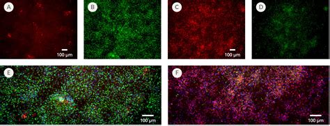 Stemdiff Midbrain Neuron Differentiation Kit