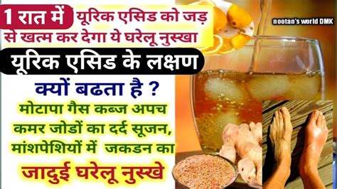 यूरिक एसिड का इलाज Uric Acid Ke Lakshan Uric Acid Kam Karne Ke Upay Kaise Hota Hai And Dava