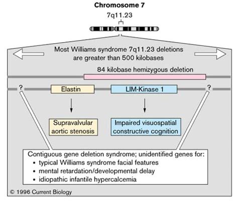 Human Genetics Dissecting Williams Syndrome Current Biology