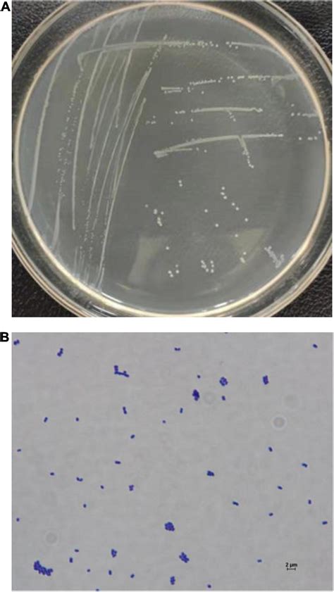 Frontiers Isolation And Characterization Of A Novel Human Intestinal