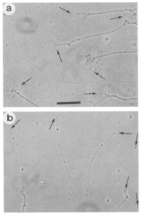 A Growth Cone Collapse Of Chick Retinal Neurons Induced By Neurotoxin