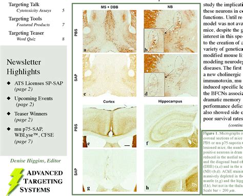 Figure From Selective Lesion Of Basal Forebrain Cholinergic Neurons