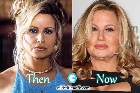 Jennifer Coolidge Before And After