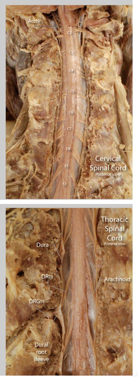 Oren Gottfried Md On Twitter Check Out This Fantastic Spinal Cord