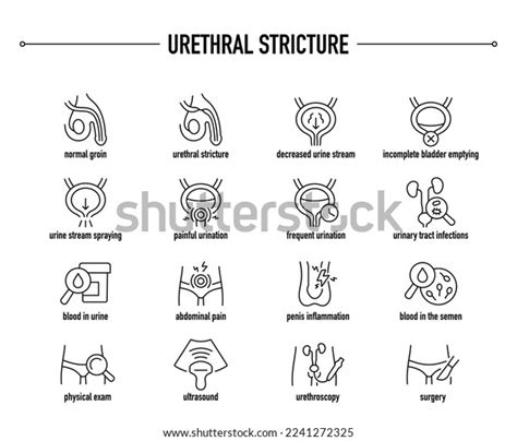 Urethral Stricture Symptoms Diagnostic Treatment Icon Stock Vector ...