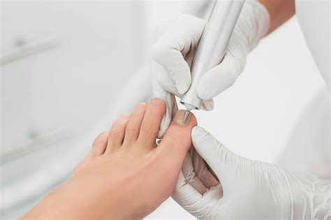 Medical Pedicures Perth Scarborough Doubleview Podiatry