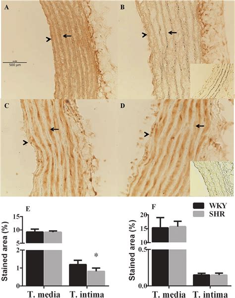 Micrographs Of Aorta Sections Of Wky A C And Shrs B D After Ihc Download Scientific Diagram