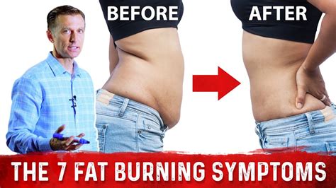 The Signs Symptoms That Prove You Are Burning Fat Dr Berg Youtube