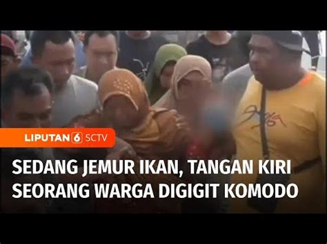 Seorang Ibu Di NTT Digigit Komodo Saat Sedang Jemur Ikan Tangan Korban