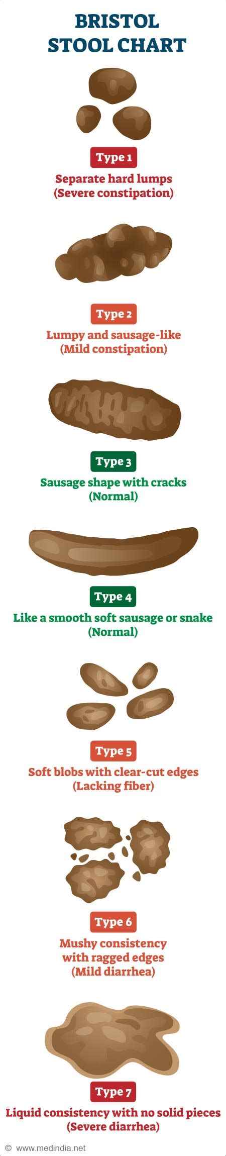 Types Of Stool