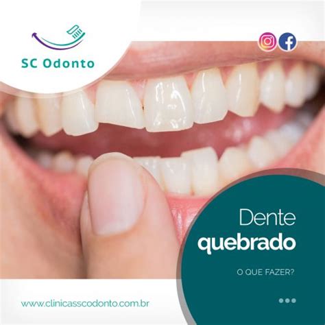 Dente Quebrado O Que Fazer Sc Odonto