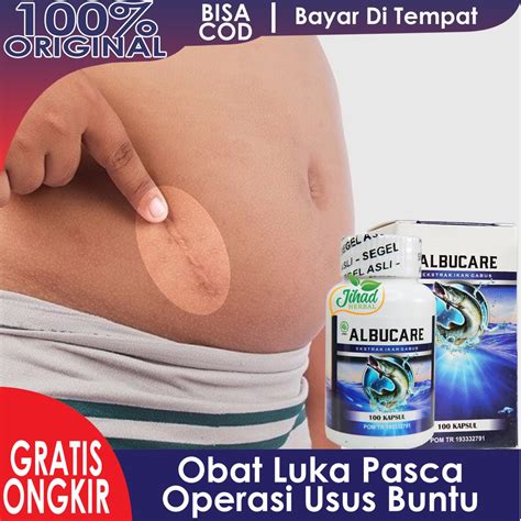 Jual Obat Luka Dalam Pasca Operasi Usus Buntu Penghilang Nyeri Sesudah