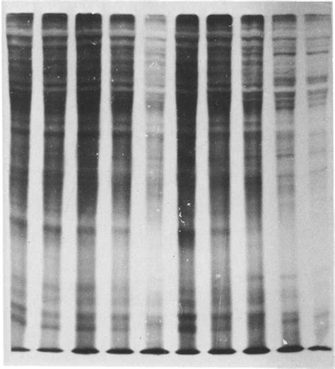 Sds Polyacrylamide Gel Electrophoresis And Fluorography Of