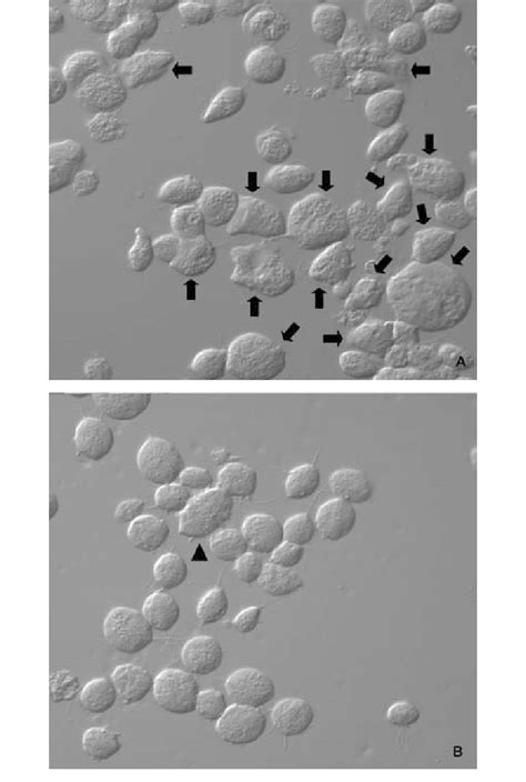 Trichomonas Culture