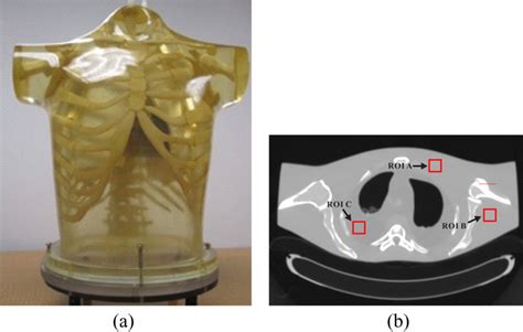 Illustration Of An Anthropomorphic Torso Phantom A And B A Ct Download Scientific Diagram