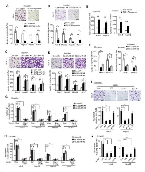 Figure From Glutaminase Is A Novel Negative Regulator Of Small