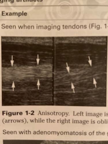 Chapter 1 Abdominal Sonography Review Flashcards Quizlet