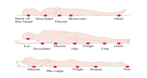 Pressure Ulcer Positioning