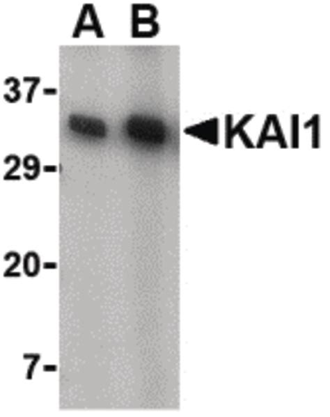 Ihc Plus™ Cd82 Polyclonal Antibody Rabbit Anti Human Lsbio