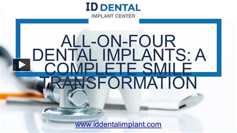 Ppt All On Four Dental Implants A Complete Smile Transformation