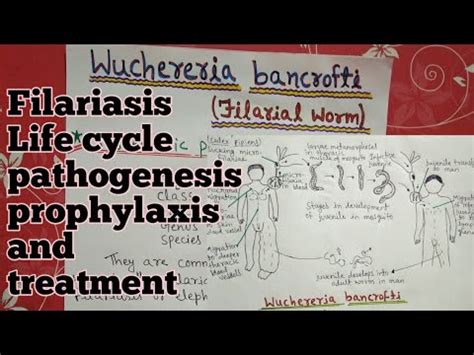 Wuchereria Bancrofti Life Cycle Full Notes Explain In Hindi Part