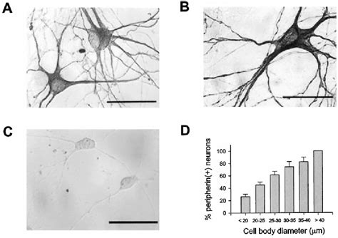 Figure From Ampa Receptor Calcium Permeability Glur Expression And